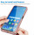 360° Grad Hülle Xiaomi Redmi 10 2022 Handyhülle mi Integriertem Displayschutz Rosa
